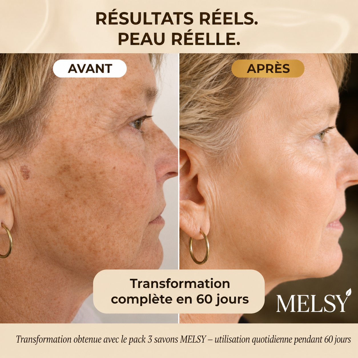 Savon Anti-Taches Melsy